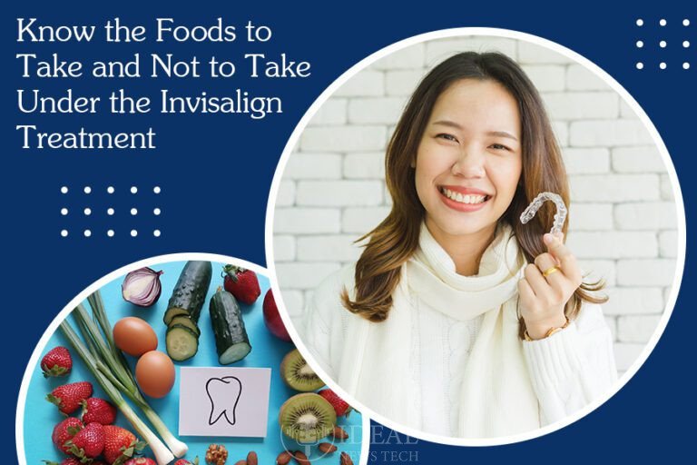 Know-the-Foods-to-Take-and-Not-to-Take-Under-the-Invisalign-Treatment Know the Foods to Take and not to Take Under the Invisalign Treatment